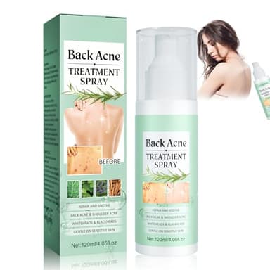 Back Acne Spray, Acne Espalda, Crema Acne Pecho y Espalda, Limpieza Profunda para Una Piel Más Suave, 120 ml