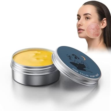 Pemarlis Organics Acne Balm, Crema hidratante reparadora de la piel, Crema nutritiva para la piel, Crema limpiadora de acné para hombre, Crema para Aclarar El Acné para Adolescentes Y Adultos