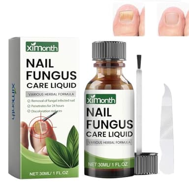 Tratamiento de hongos en las uñas de los pies, extra fuerte, tratamiento de uñas, tratamiento de hongos en las uñas de los pies y las uñas, protege uñas gruesas, rotas y decoloradas, 30 ml