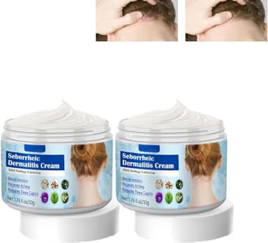 EXQST Crema para Dermatitis seborreica Crema para el Cuero cabelludo para Psoriasis Crema antipicazón para Alivio calmante Crema hidratante tonificante Alivio eficaz para la picazón Seca