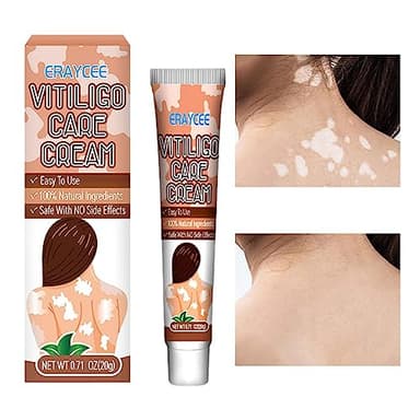 Crema Piel para Vitíligo, Crema Repigmentación y Alivio del Vitíligo 20g, Reduce las manchas blancas, mejora los melanocitos epidérmicos, restaura el vitíligo la piel