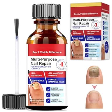 Tratamiento Uñas Pies, Reparadores de Uñas Solución, Cuidado Uñas Dañadas, Fortalece la Uña, La Uña se Regenera de Forma Natural, Restaura el Aspecto Natural de Las Uñas, 30ml, Rojo