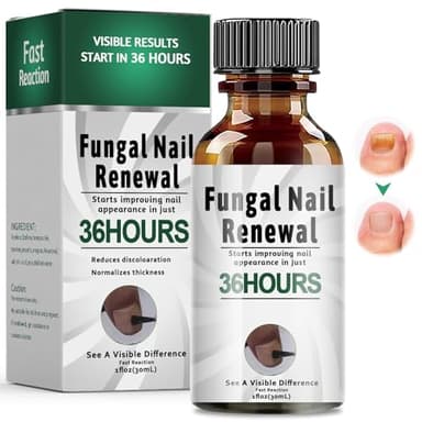 30ml Gotas para Cuidado De Uñas De los Pies,Reparadores de Uñas Solución,Calmar y Nutrir Las uñas,cuidado Diaria y Mejora Aspecto,Para Dañadas Y Descoloridas