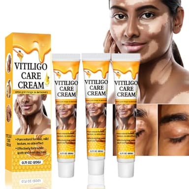 3pcs Crema De Cuidado De Vitiligo Para La Piel Vitiligo,Crema De Vitiligo,Elimina Las Manchas Blancas,Cremas Para El Cuidado Del Vitiligo,Mejora La Pigmentación Reguladora De La Crema De Vitiligo