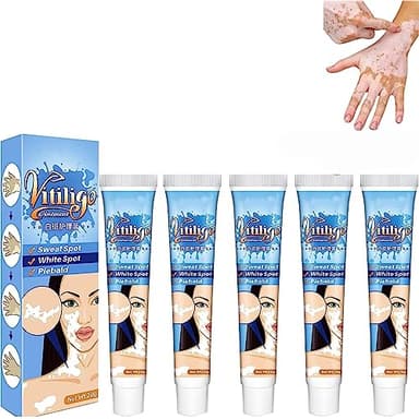 Crema de terapia de vitíligo Parches blancos en la crema de tratamiento de la piel Crema de vitíligo para reducir las manchas blancas Pomada de alivio de vitíligo Mejorar la pigmentación de la piel